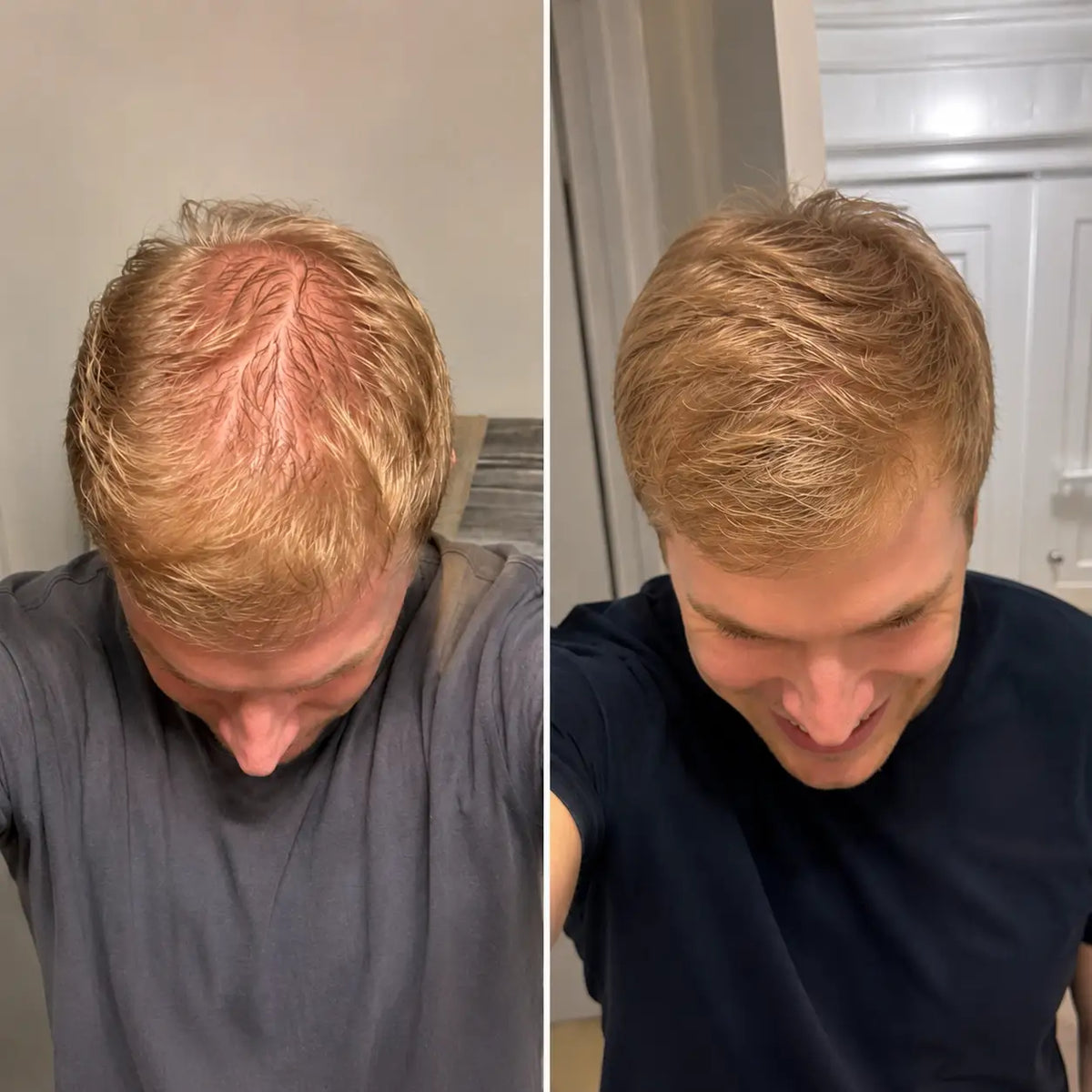 Cheveux plus dense en 8 semaines