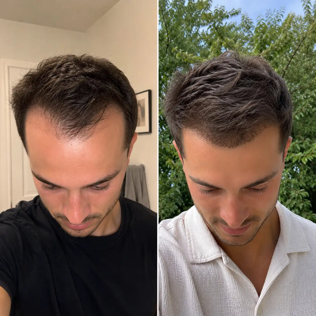 Cheveux plus dense en 8 semaines